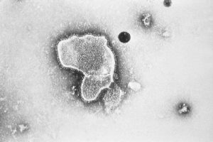 RSV virus image from a microscope from the Public Health Image Library
