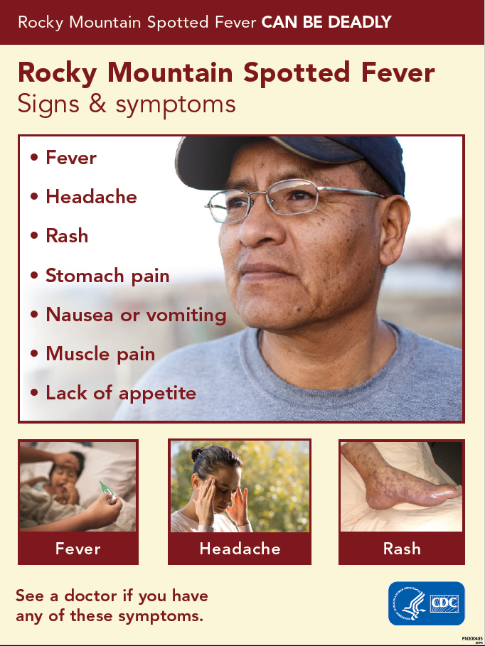 Flyer on symptoms of Rocky Mountain spotted fever including fever, headache, rash, stomach pain, nausea or vomiting, muscle pain, lack of appetite. 