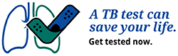 A TB test can save your life. Get tested now.