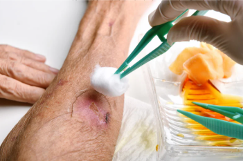 Wound care image sourced from Canva