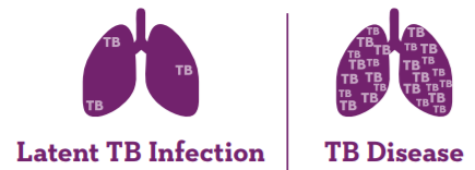 = Graphics showing lungs with latent TB infection have less TB in them compared to TB disease