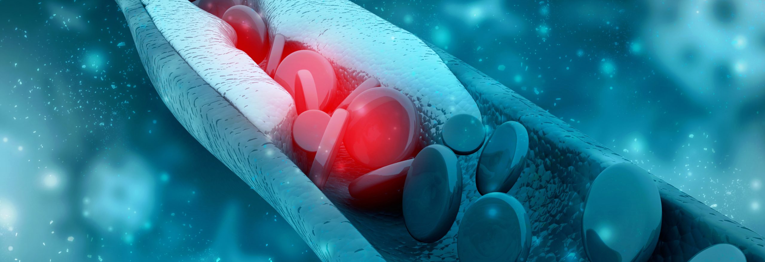 3D image illustrating high cholesterol