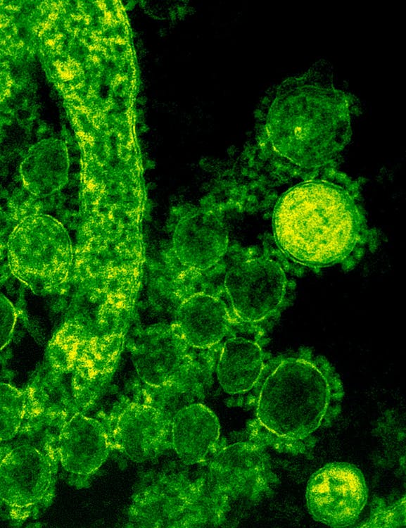 Image of virus under microscope