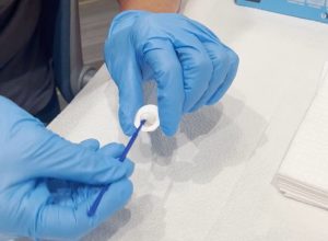 Tay đeo găng sử dụng một công cụ để loại bỏ fluoride khỏi cốc dùng một lần để bôi lên răng sữa.